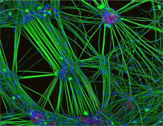 Победители конкурса микрофотогарфии Small World Photomicrography 2016