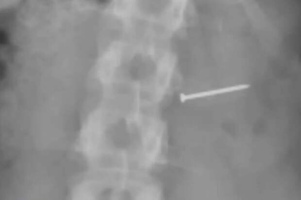 В США женщина съела мороженое с гвоздями и получила $14 млн