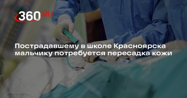 Пострадавшему в школе Красноярска мальчику потребуется пересадка кожи