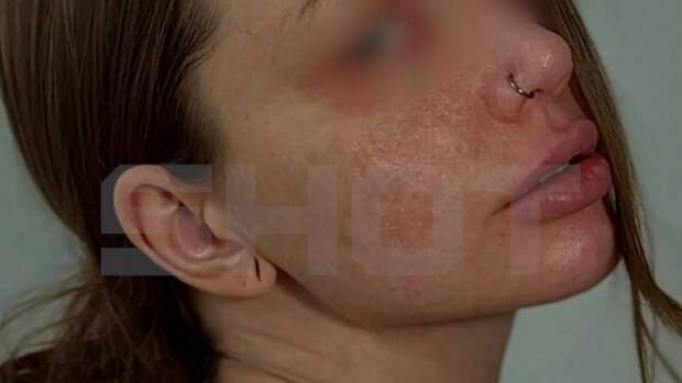 Жительница Москвы едва не погибла из‑за неправильно назначенного лекарства