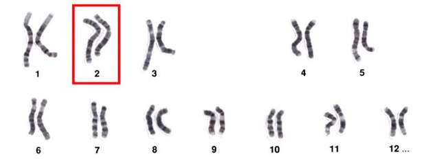 Хромосома №2 .