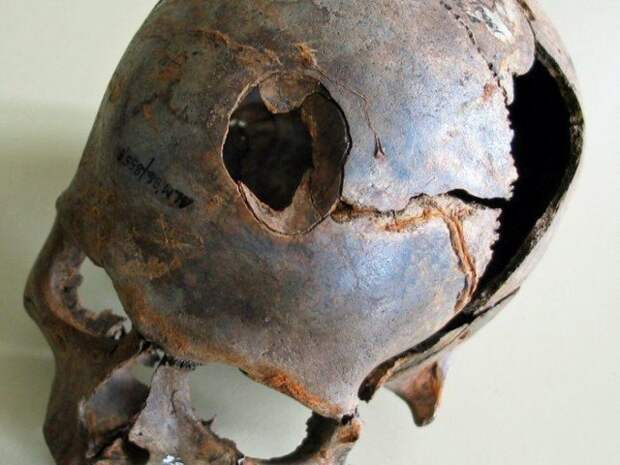 А вот этому обладателю черепа, проломили череп дубиной, напоминающей клюшку. Остатки таких дубин так же были найдены. история, мумии, наука, скелеты