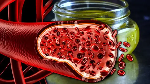 6 правил питания для здоровых сосудов и обзор продуктов для их укрепления и очищения