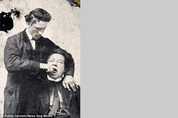 Ужасы викторианской стоматологии! Фотографии, от которых ты спрячешься под стол! Ужасы викторианской стоматологии! Фотографии, от которых ты спрячешься под стол!