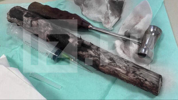 Неудачное падение: мужчина проткнул челюсть черенком лопаты во время чистки снега