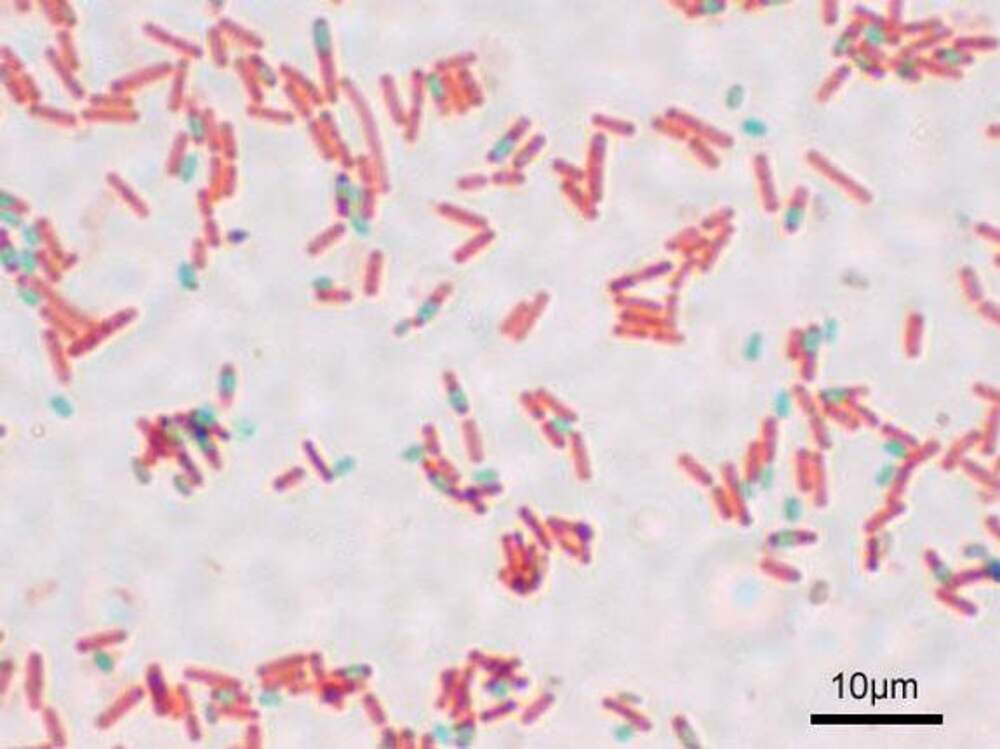 Окраска спор бактерий. Bacillus subtilis окраска по Ожешко. Bacillus subtilis (Сенная палочка) споры. Bacillus subtilis Ожешко. Бациллы Ожешко.