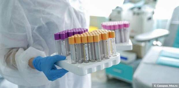 Число заболевших COVID-19 в мире за сутки вновь превысило рекордное значение / Фото: Е.Самарин, mos.ru