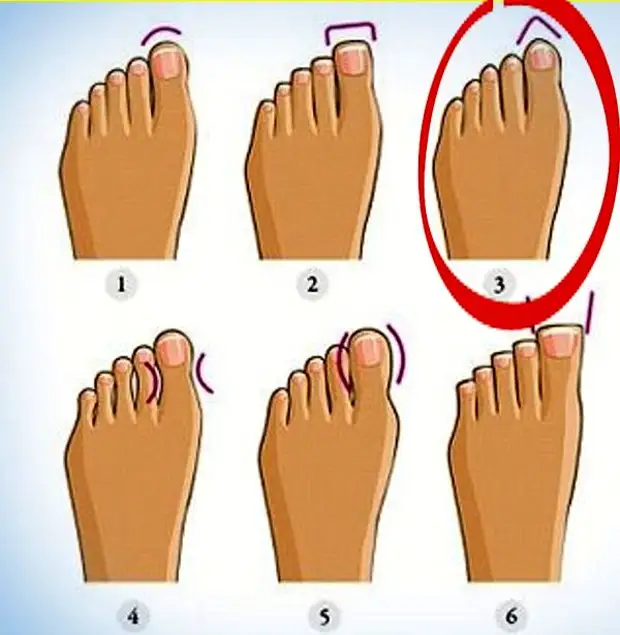 Тест большого пальца. Форма пальцев на ногах. Форма пальцев стопы. Форма большого пальца на ноге. Правильная форма пальцев на ногах.
