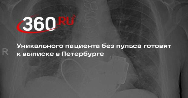 Уникального пациента без пульса готовят к выписке в Петербурге