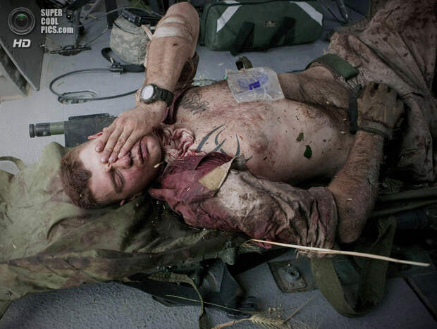 Афганистан. Сангин, Гильменд. 4 июня 2011 года. Бёрнесс Бритт, раненый шрапнелью в шею и голову. (AP Photo/Anja Niedringhaus)