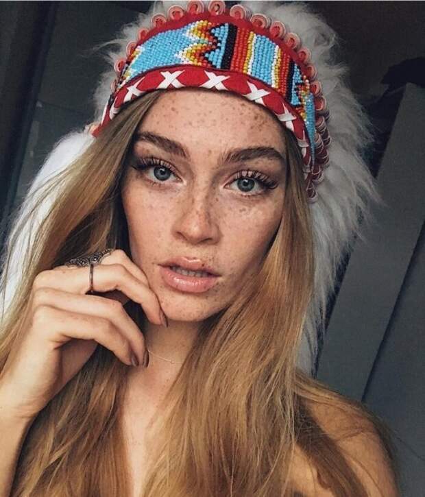20+ девушек с веснушками, которых расцеловало солнце