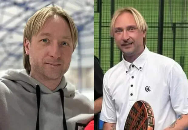 Евгений Плющенко до и после блефаропластики