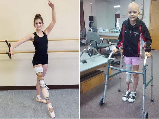 Габи Шалл - целеустремленная девушка-танцовщица, победившая рак