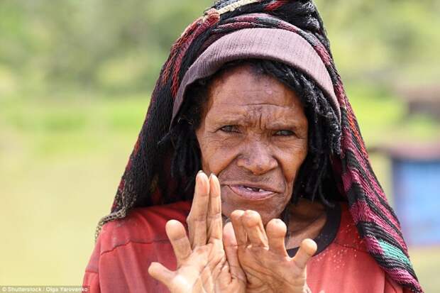 В племени Дани (провинция Папуа, Индонезия) некоторые женщины - вроде той, что на фотографии - отрезают фаланги пальцев, когда умирает их родственник модификации, модификация тела, народы мира, традиции мира