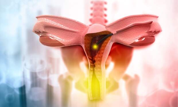 Врач составила идеальное меню при запорах