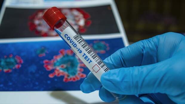 Точность ПЦР-тестов на коронавирус оценили в депздраве