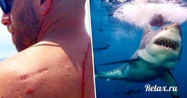 Акула напала на мужчину и спасла ему жизнь