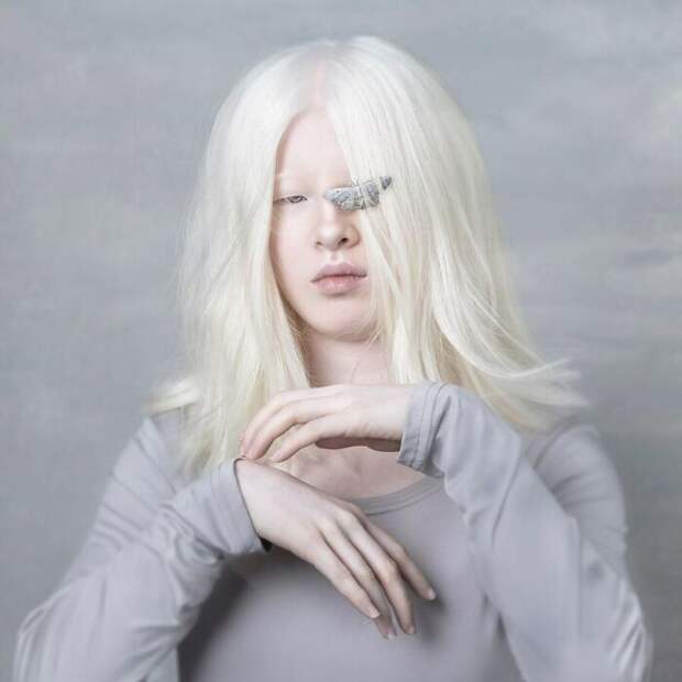 Meet-Chinese-Xueli-Abbing-the-albino-abandoned-when-she-was-a-baby-who-became-a-Vogue-model-6090ff2670682__700.jpg