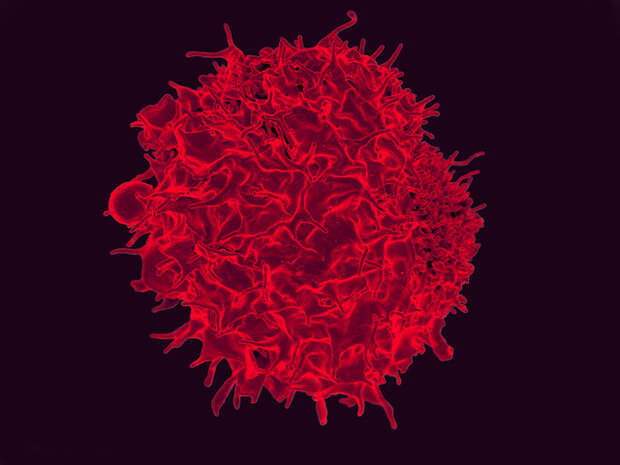 Пациент с ВИЧ впервые получил CRISPR-отредактированные клетки крови