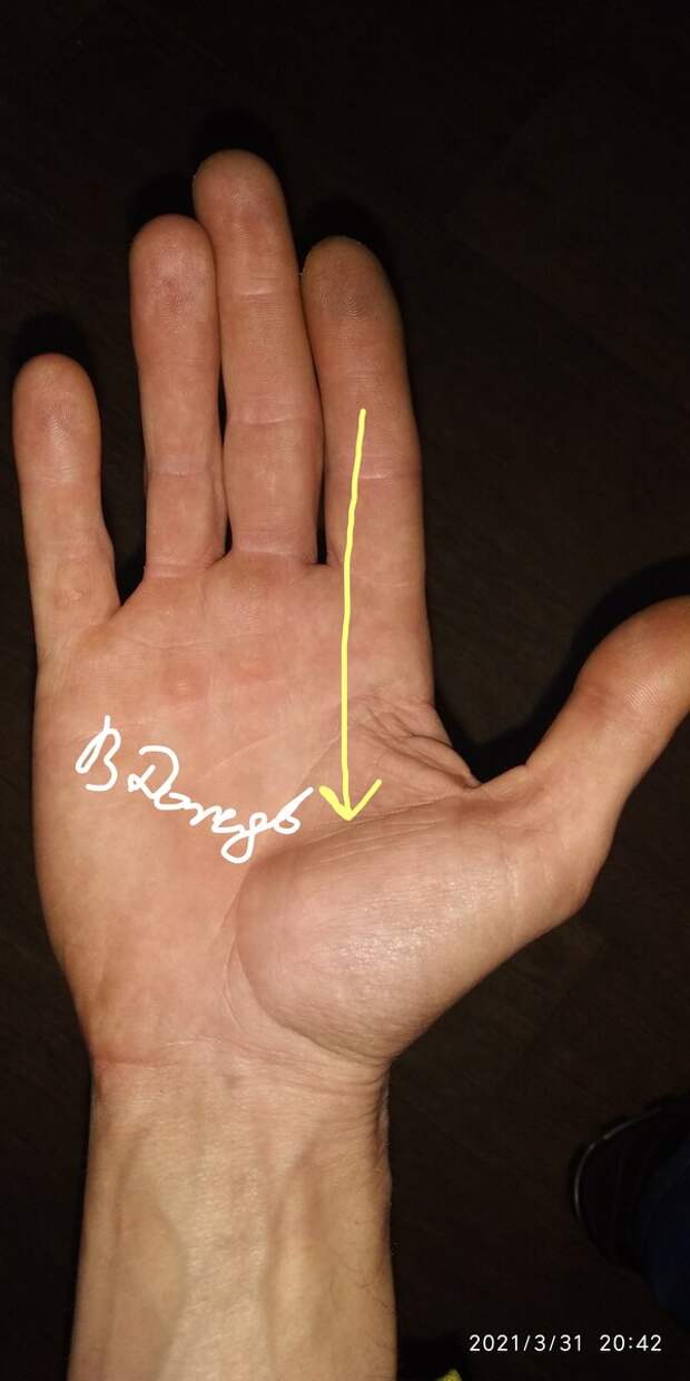 Линия порчи на руке, указывающая на негатив или магическое воздействие