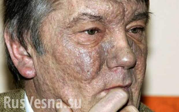 Не прошло и 15 лет: доказательств отравления Ющенко не нашли (ВИДЕО) | Русская весна