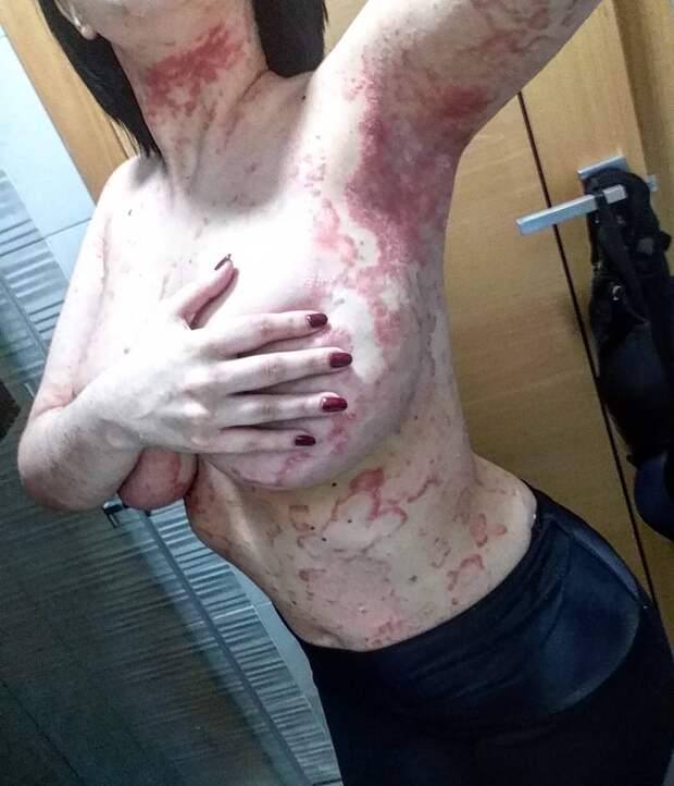 26-летняя девушка прятала свое тело под одеждой, но потом поделилась снимками и стала популярной
