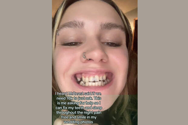 23-летняя блогерша останется без всех зубов из-за одной причины