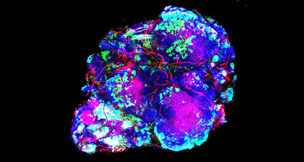 mouse breast tumor