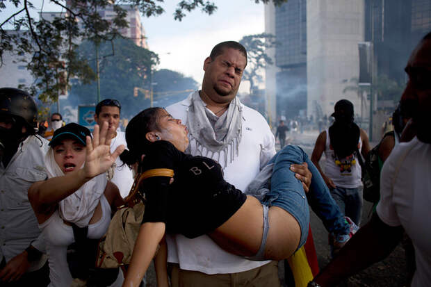 APTOPIX Venezuela Protests