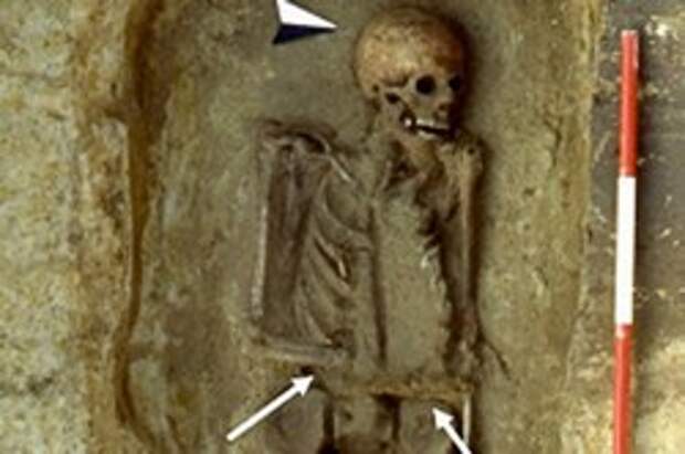 Археологи нашли первого в мире средневекового "киборга"