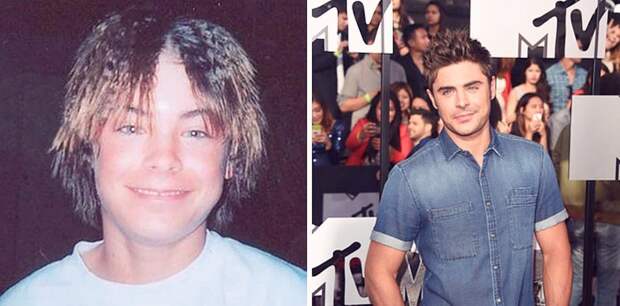 FormerlyAwkwardCelebs01 Вечно недовольны собственной внешностью? Всего 20 фото докажут, что надежда есть!