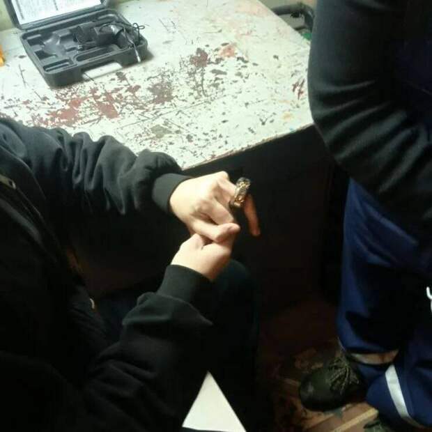 Подростку из Татарстана помогли снять застрявший на пальце спиннер