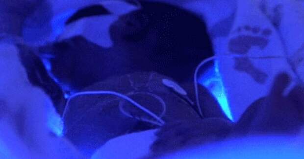 Обтирание полотенцем не снизило риск переохлаждения у крайне недоношенных новорождённых