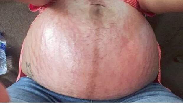 26 правдивых фотографий, которые показывают, что такое беременность на самом деле