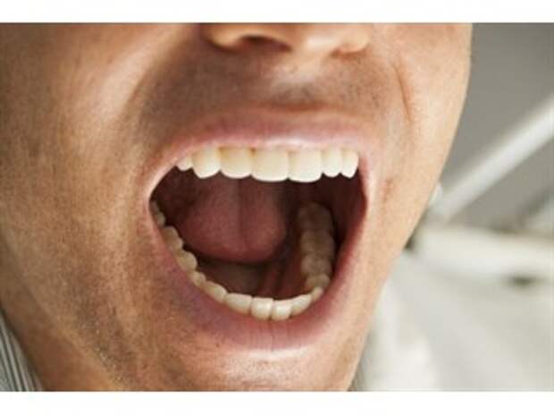 Учёные утверждают, что создали леденец, способный восстанавливать зубную эмаль
