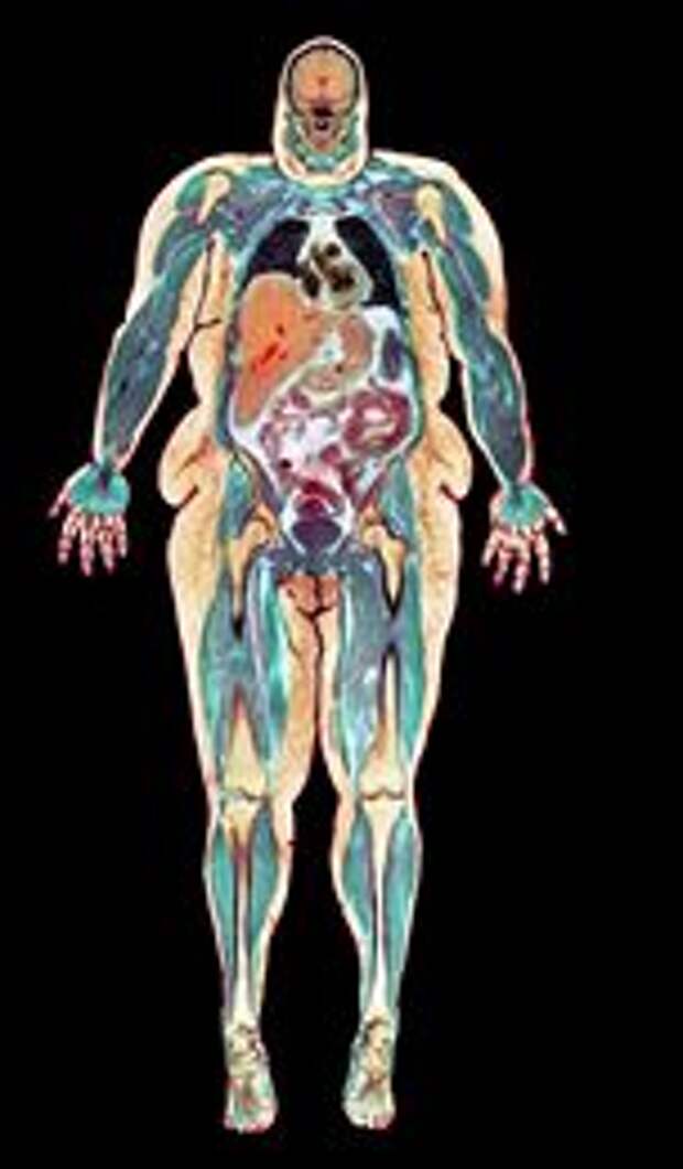 Толстый человек анатомия. Анатомия толстых людей. Рентген тела Толстого человека.