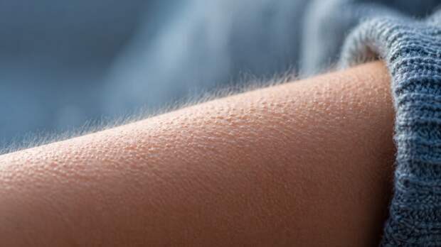 Мурашки по коже: зачем организм включает этот древний рефлекс