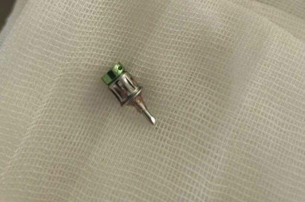 Пациент проглотил стоматологический бур в клинике Подмосковья