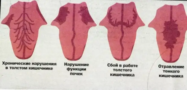 Язык карта организма