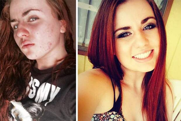 Преображения бывших наркоманов (21 фото)