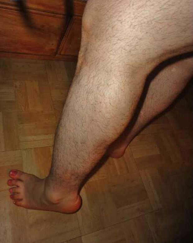 Фото волосатые ноги у женщин