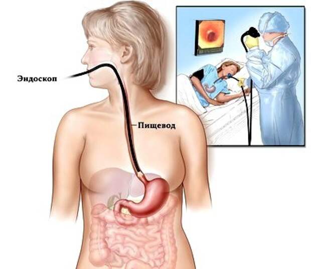 Эндоскопия картинки прикольные
