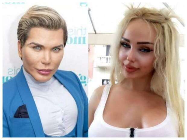 2 миллиона за пластику, покорение
