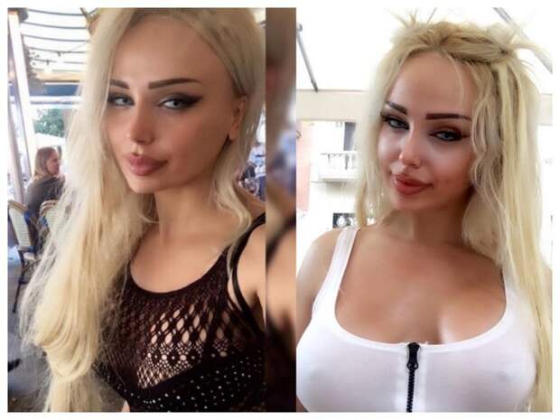 2 миллиона за пластику, покорение