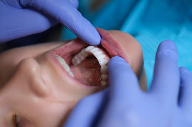 Стоматолог Ферах Хамид рассказал, что зубы желтеют из-за кислой пищи