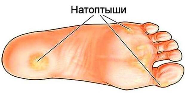 1517569686_safe_image-1024x536