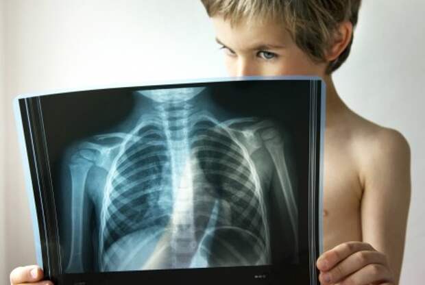 Пневмония у детей: симптомы, лечение и профилактика воспаления легких