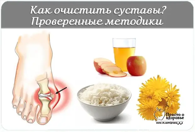 Как проверить суставы. Стадии деформирующего артроза. Синовиальная оболочка коленного сустава. Деформирующий артроз коленного сустава схема. Первичный деформирующий остеоартроз.