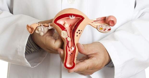 Невидимая боль: почему самую частую женскую болезнь десятилетиями не могут обнаружить?