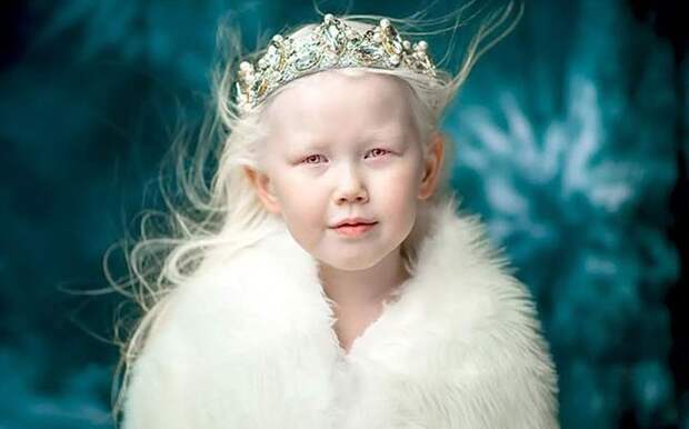 Якутская девочка-альбинос очаровала Интернет